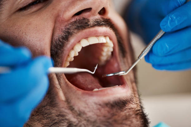 Best Walk-In Emergency Dentist in Estancia, NM