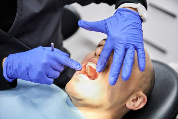 Best Emergency Root Canal Treatment in Estancia, NM